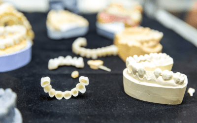 Diferencias entre puentes e implantes dentales