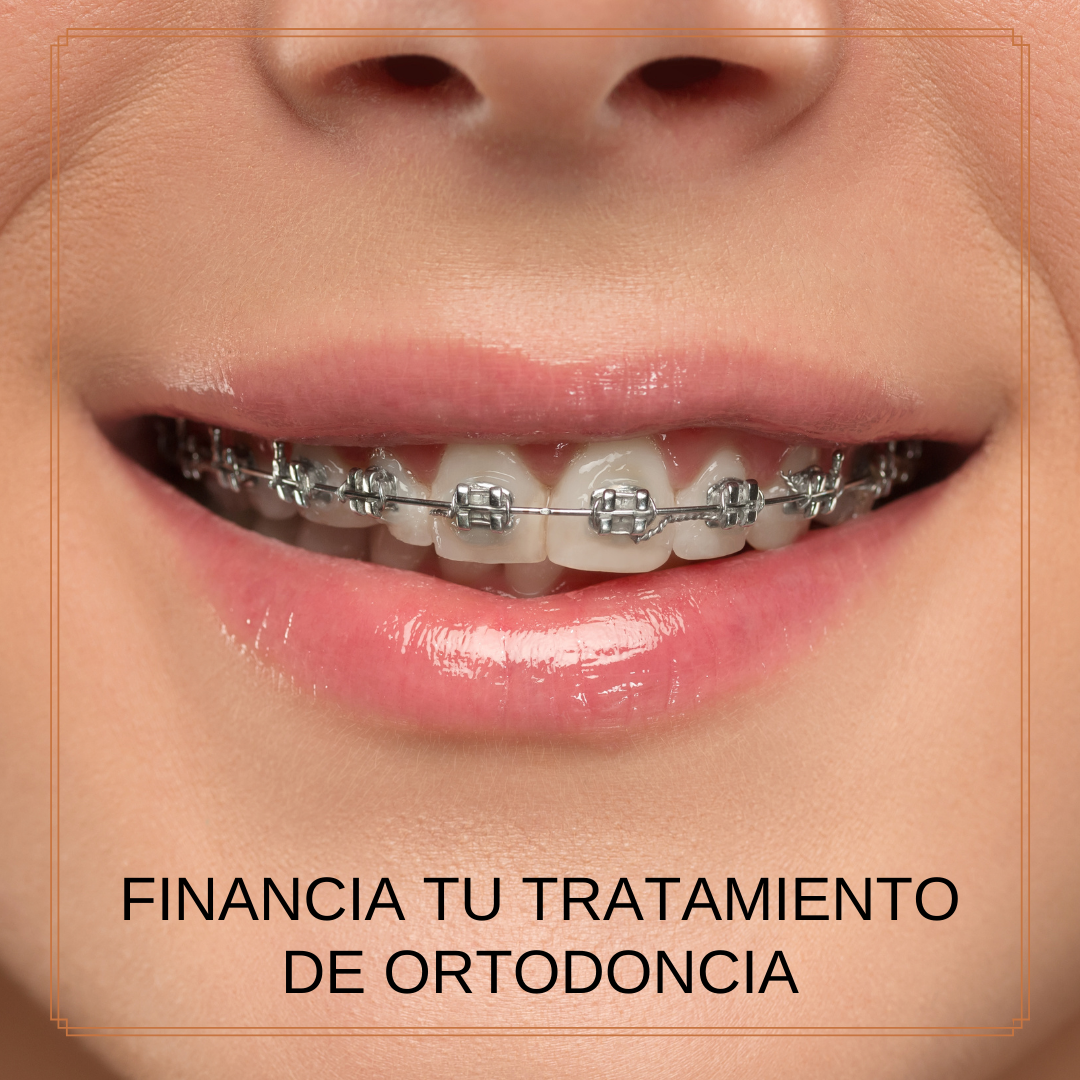 ortodoncia dentalbaron