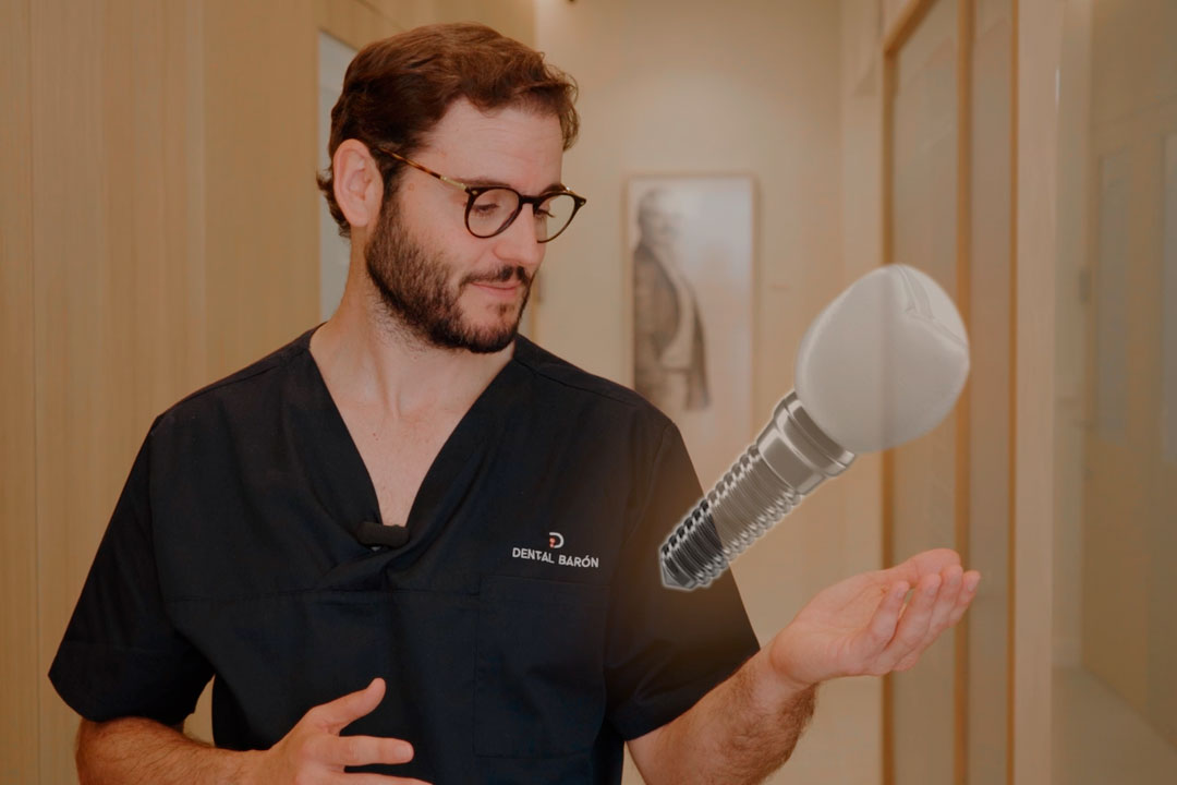 tratamiento implantes dentales en El Puerto de Santa María