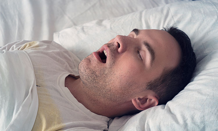 paciente con ronquido y apnea del sueño